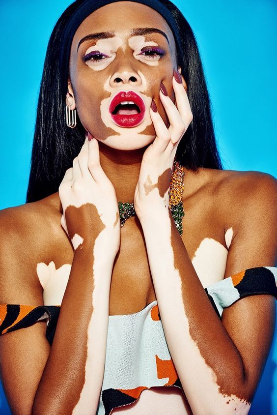 Winnie Harlow min