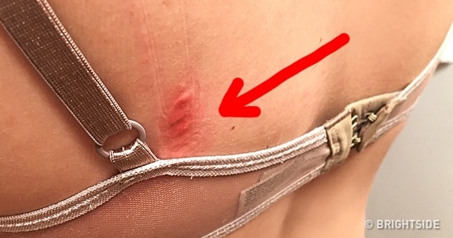 Poorly fitted bras min